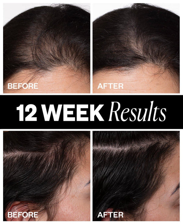 a collage of hair loss results