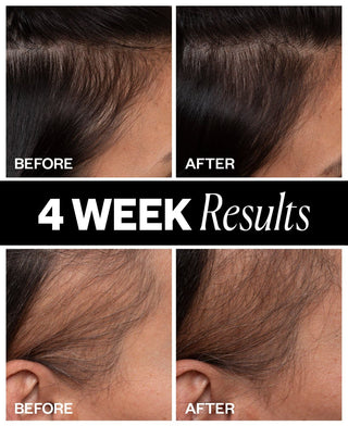 a collage of hair loss results